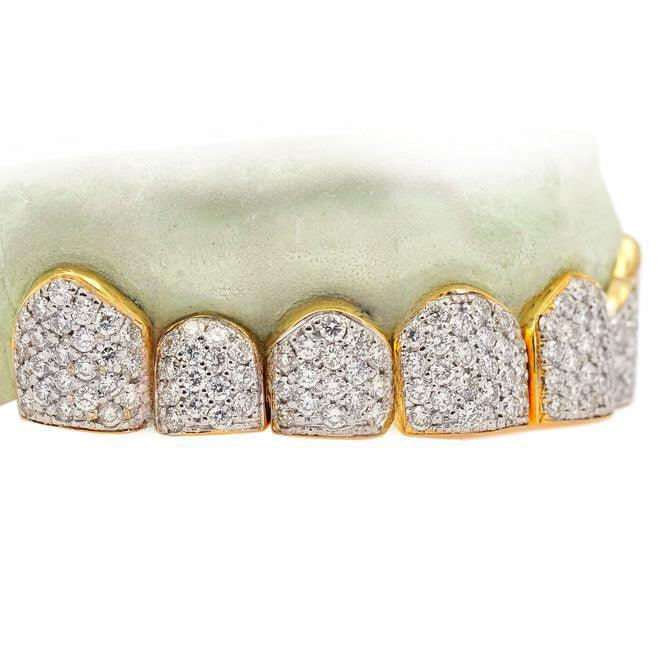 Two Tone Gold & Diamond Pave Top Six Grillz