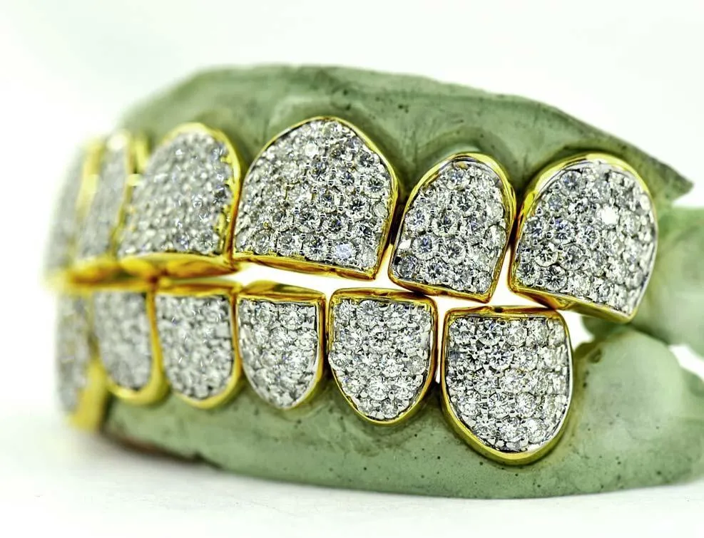 Full Pave Diamond Yellow Gold Top & Bottom Grillz