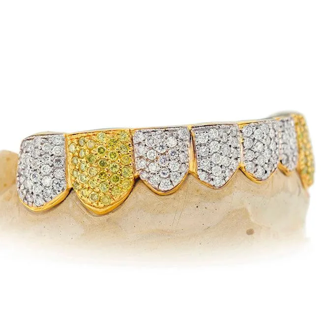 Canary & White Diamond Pave Top Grillz