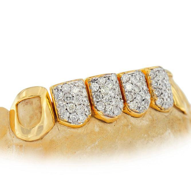 Yellow Gold 4 Piece Diamond Pave Grillz