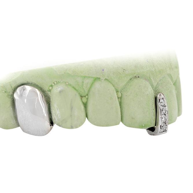 White Gold Single Cap with Diamond Side Tooth