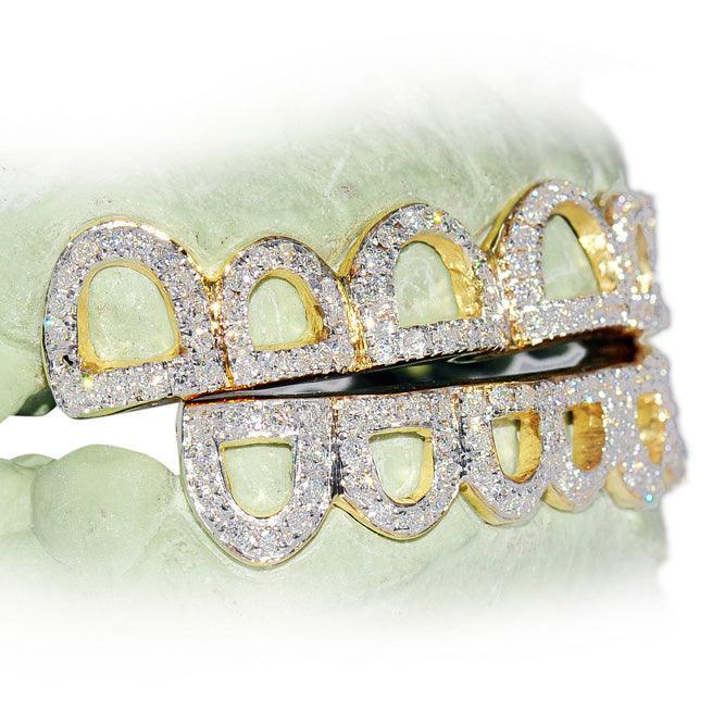 Iced Out Open Face Top & Bottom Diamond Grillz