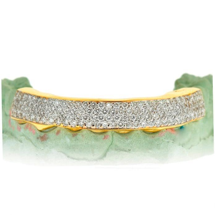 Three Row Diamond Pave Bottom Grillz — Yellow Gold