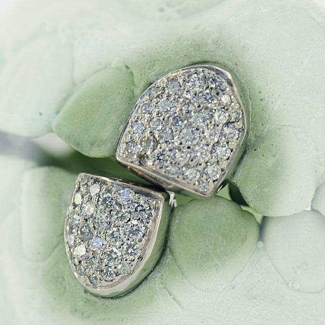 2 Piece Pave Diamond White Gold Grillz
