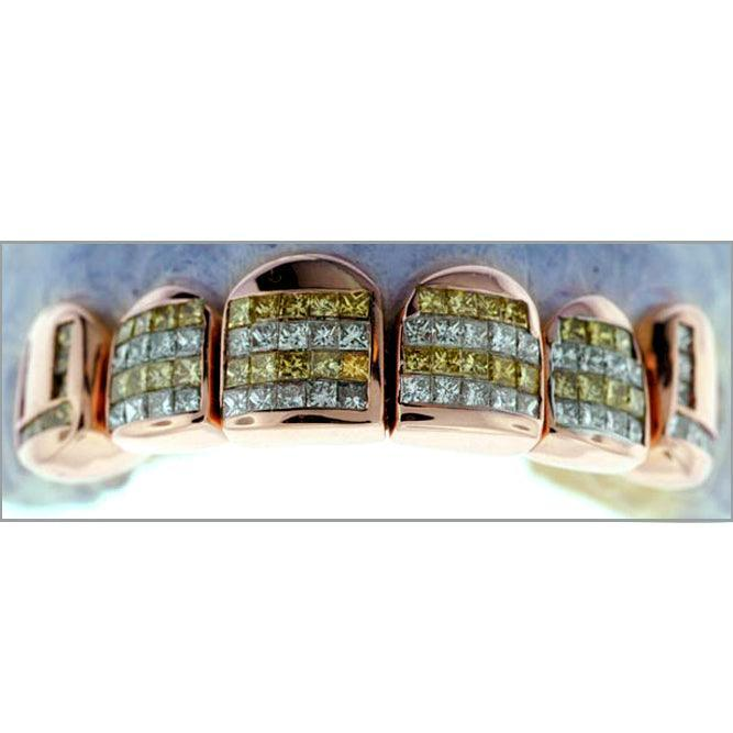 Rose Gold Canary & White Striped Invisible Set Grillz