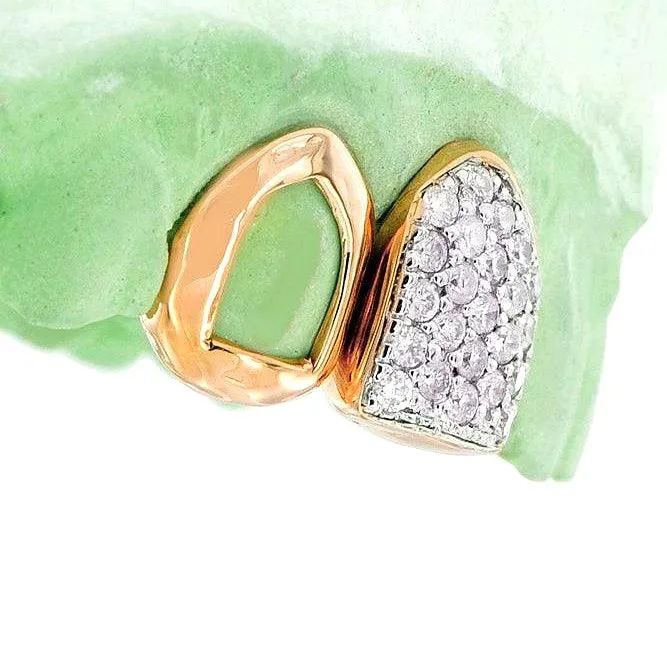 Rose Gold Open Face & Pave Diamond Two Tooth Set